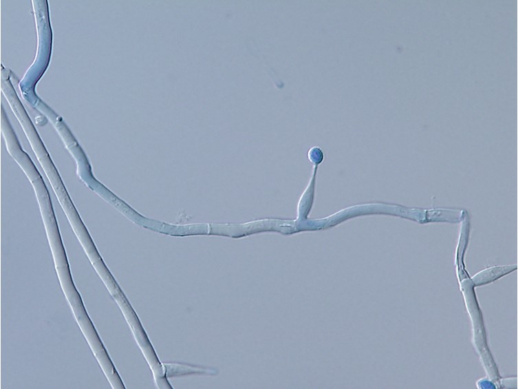 Ophiocordyceps khokpasiensis